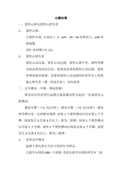 心电图