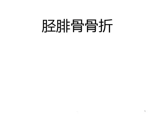 胫腓骨骨折ppt课件