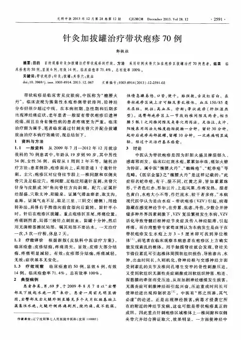 针灸加拔罐治疗带状疱疹70例