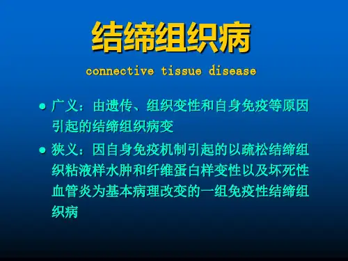 结缔组织病