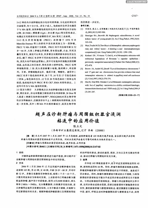 超声在诊断肿瘤与周围组织器官浸润粘连中的应用价值
