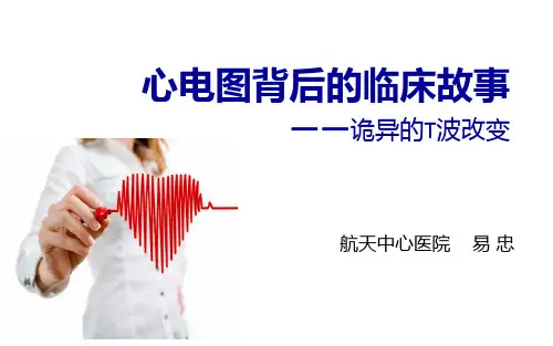 心电图背后的临床故事-诡异的T波(易忠)