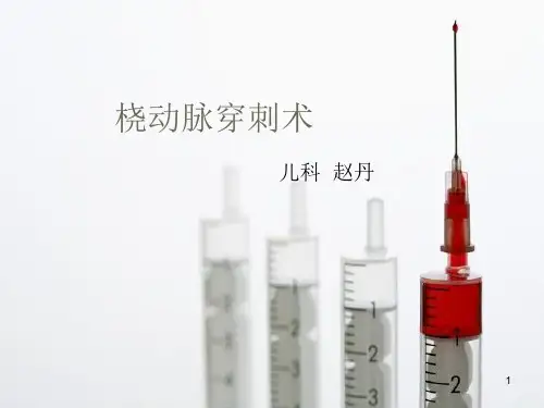 (参考课件)桡动脉穿刺术