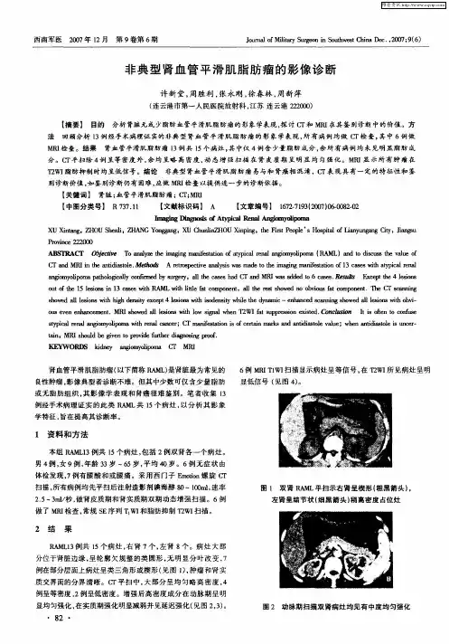 非典型肾血管平滑肌脂肪瘤的影像诊断