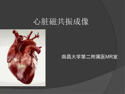 心脏磁共振成像ppt课件