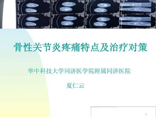 骨性关节炎疼痛特点及治疗对策