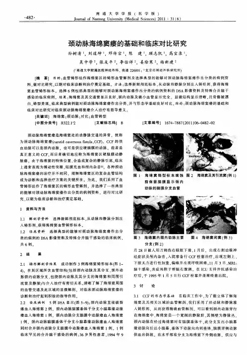 颈动脉海绵窦瘘的基础和临床对比研究