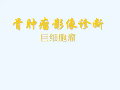 骨巨细胞瘤影像诊断
