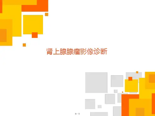 肾上腺腺瘤影像诊断