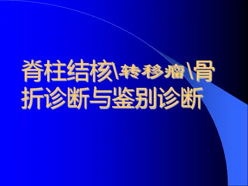 脊柱结核-转移瘤--骨折诊断与鉴别诊断