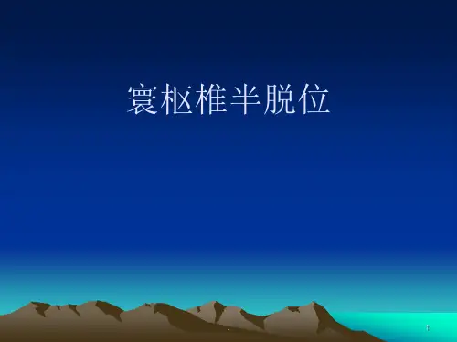 寰枢椎半脱位PPT课件