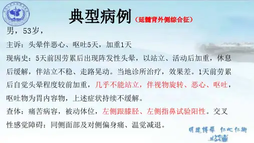 延髓背外侧综合征----脑干综合征之一