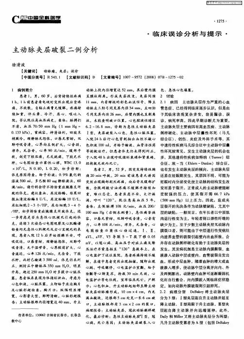 主动脉夹层破裂二例分析
