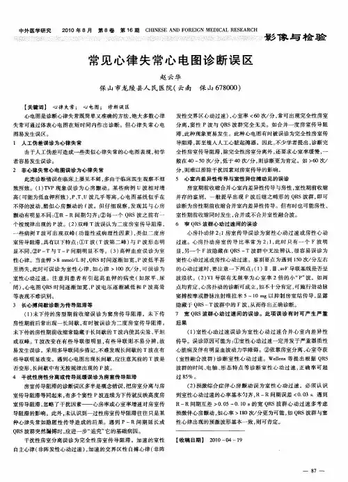 常见心律失常心电图诊断误区