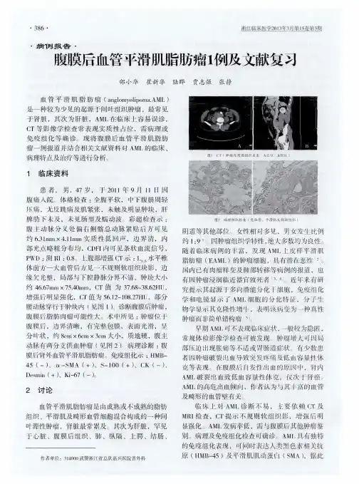 腹膜后血管平滑肌脂肪瘤1例及文献复习