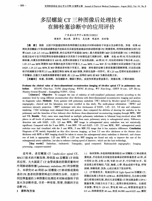 多层螺旋CT三种图像后处理技术在肺栓塞诊断中的应用评价