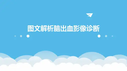 图文解析脑出血影像诊断