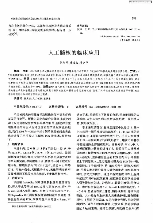 人工髓核的临床应用