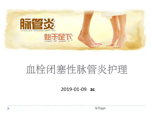 血栓闭塞性脉管炎_护理