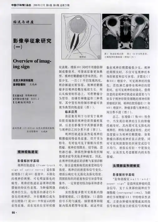 影像学征象研究(一)