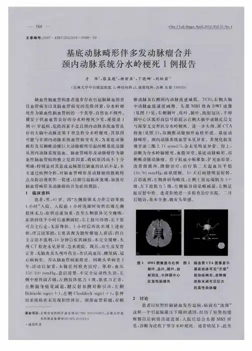 基底动脉畸形伴多发动脉瘤合并颈内动脉系统分水岭梗死1例报告