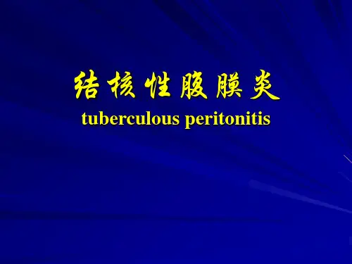 结核性腹膜炎