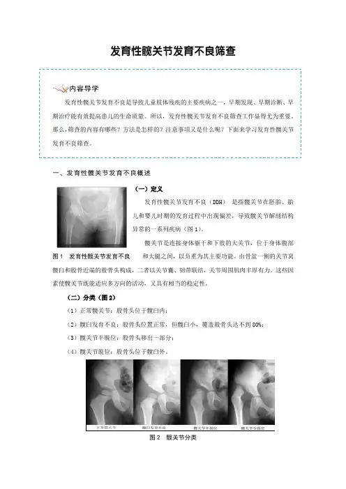 发育性髋关节发育不良筛查-讲义