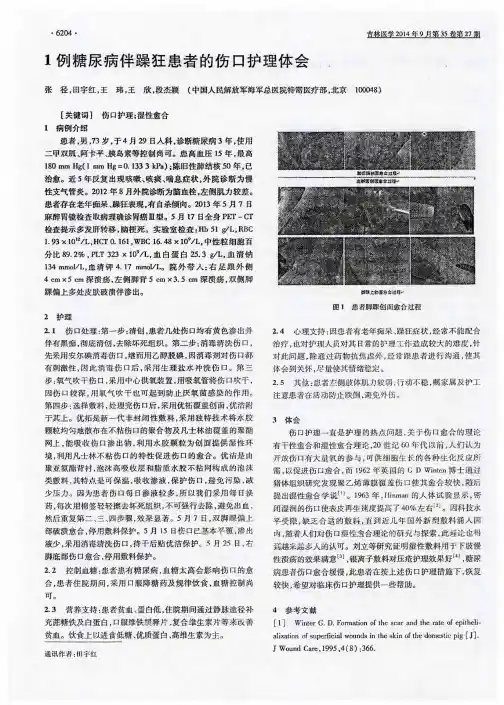 1例糖尿病伴躁狂患者的伤口护理体会