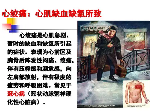 第二十八抗心绞痛药精品PPT课件