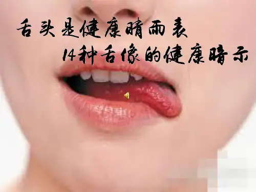 舌头是健康晴雨表14种舌像的健康暗ppt演示课件