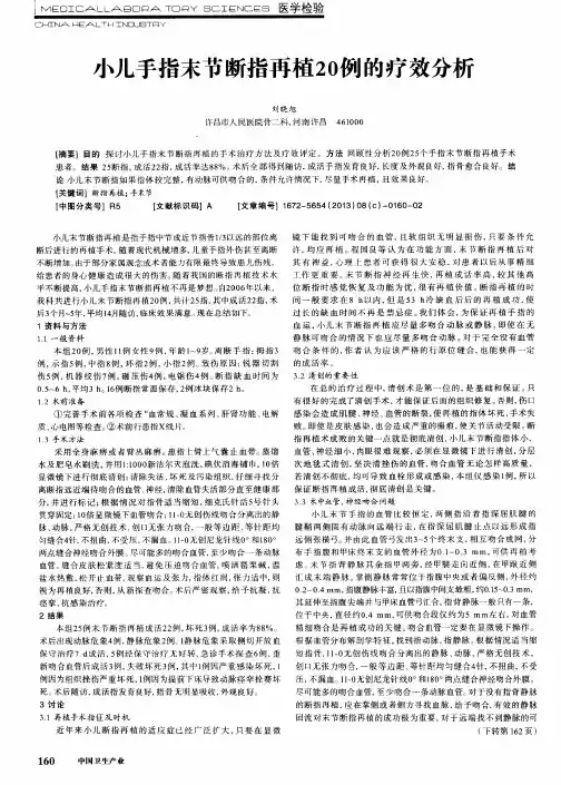 小儿手指末节断指再植20例的疗效分析