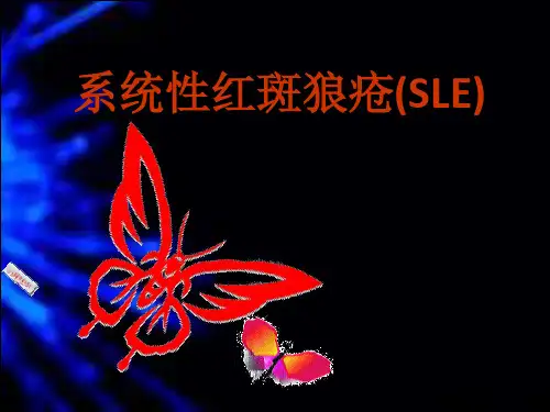 系统性红斑狼疮(较全面)