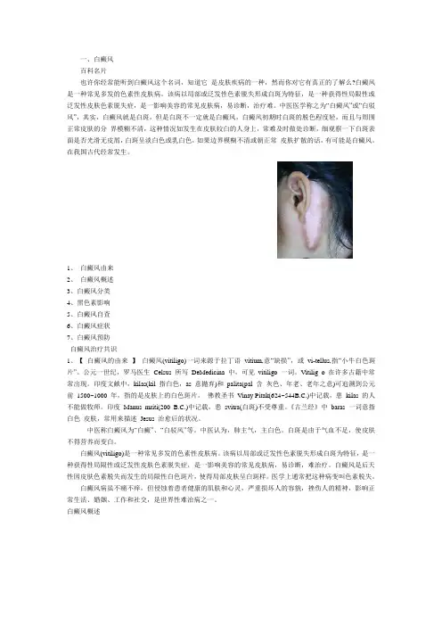 白癜风基本知识