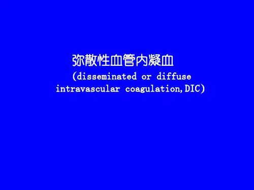 DIC弥散性血管内凝血