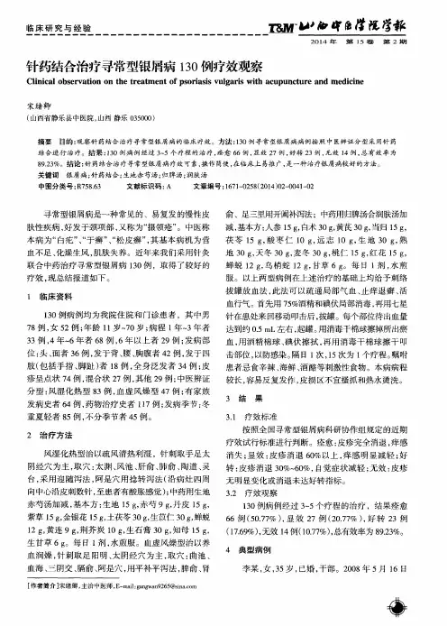 针药结合治疗寻常型银屑病130例疗效观察