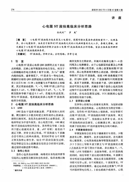 心电图ST段抬高临床分析思路