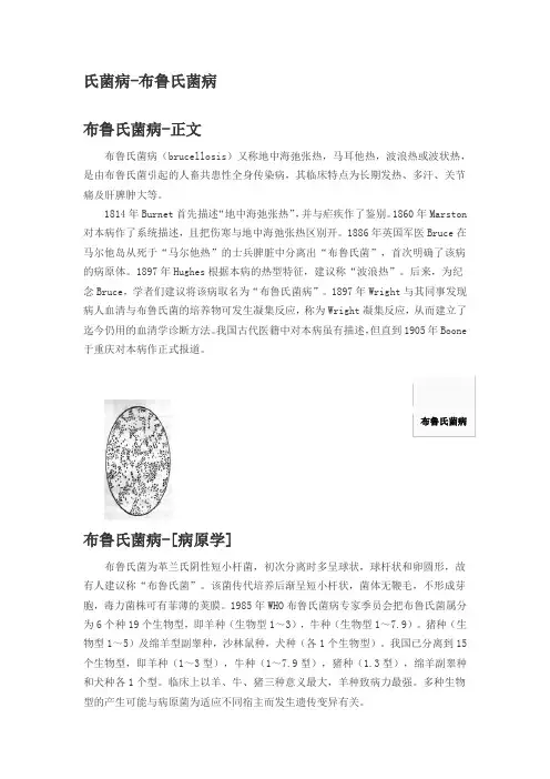布氏杆菌病 2
