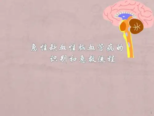 急性脑卒中的识别和急救流程ppt课件