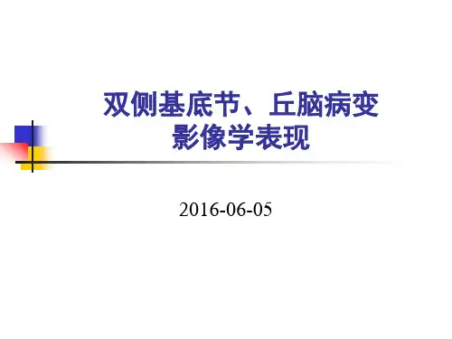 双侧基底节、丘脑病变的影像表现