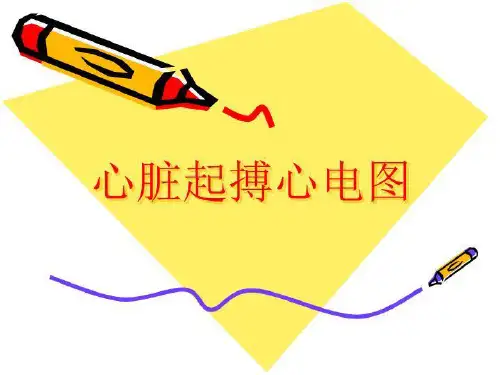 心脏起搏器心电图