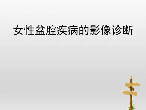 女性盆腔疾病的影像诊断