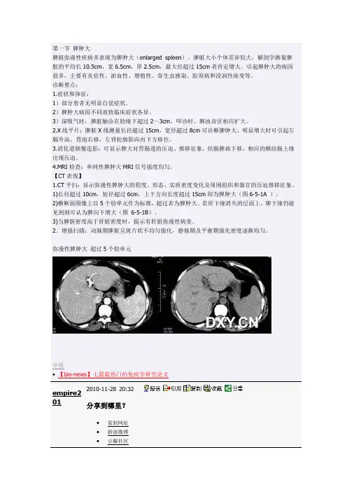脾脏CT