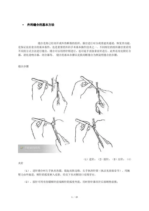 外科缝合的基本方法