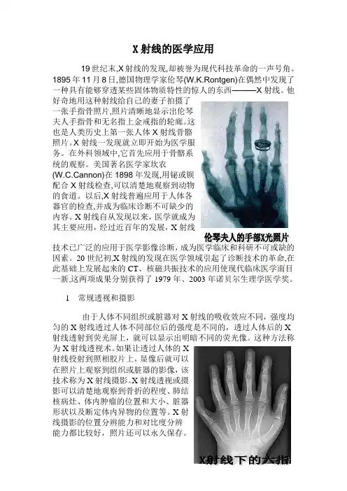 x射线在医学方面的应用