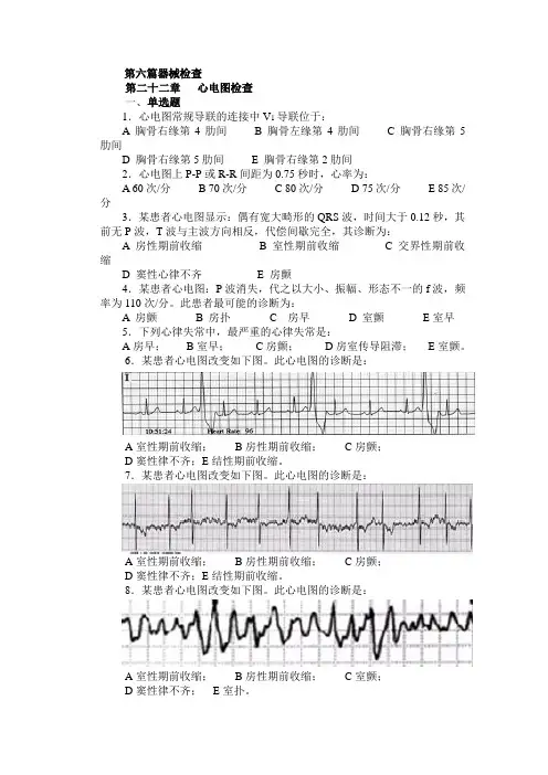 心电图检查复习题