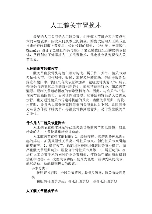 髋关节置换术宣传