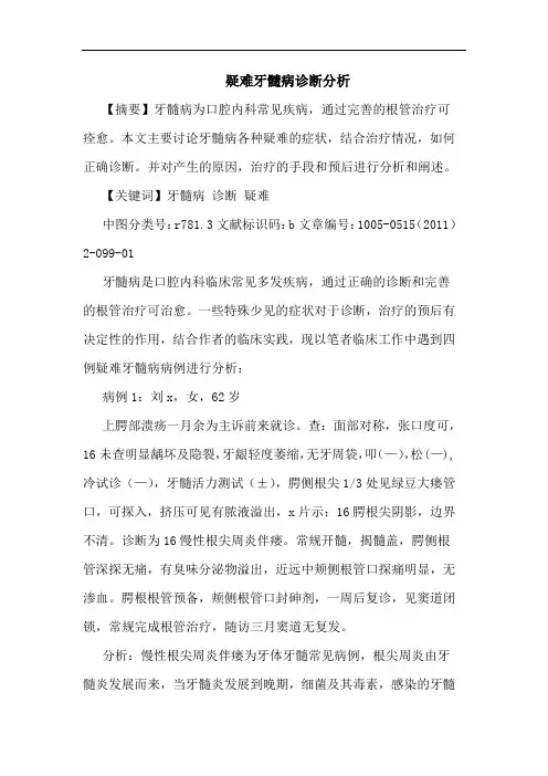 疑难牙髓病诊断论文