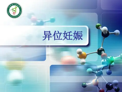 异位妊娠PPT课件