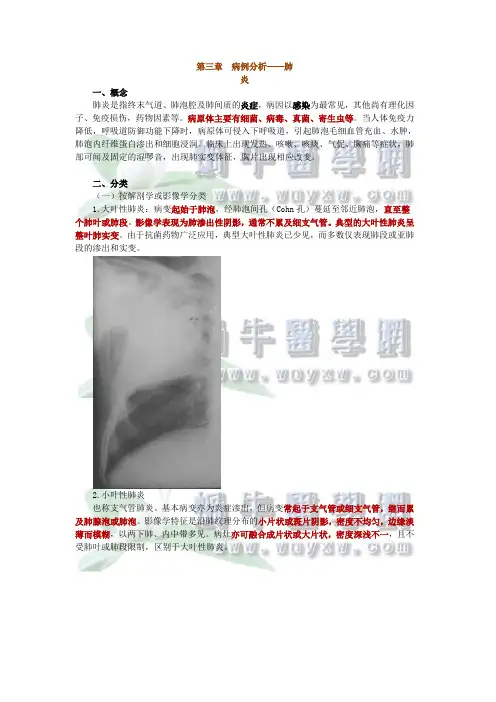 病例分析——肺炎