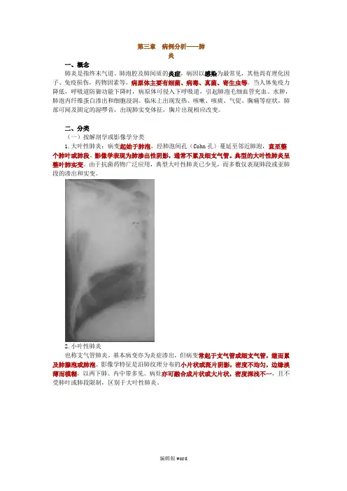 病例分析——肺炎